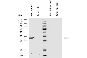 Western blotting analysis of human LIME using mouse monoclonal antibody LIME-10 on lysates of J77-LIME transfectants and Jurkat cells under reducing and non-reducing conditions. (LIME anticorps  (AA 281-296))