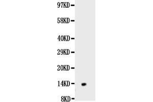 Western blot analysis of NGF/NGF Beta using anti-NGF/NGF Beta antibody . (Nerve Growth Factor anticorps  (AA 122-241))