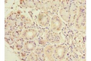 Immunohistochemistry of paraffin-embedded human pancreatic tissue using ABIN7147772 at dilution of 1:100 (CCDC108 anticorps  (AA 2-164))