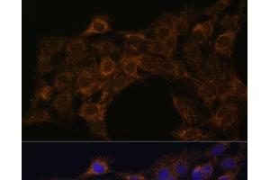Immunofluorescence analysis of C6 cells using FoxO3a Polyclonal Antibody at dilution of 1:100. (FOXO3 anticorps)