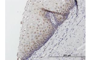 Immunoperoxidase of purified MaxPab antibody to FKBP4 on formalin-fixed paraffin-embedded human esophagus.