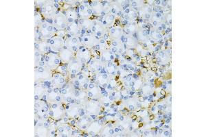 Immunohistochemistry of paraffin-embedded mouse kidney using TAPBP Antibody (ABIN1875423) at dilution of 1:200 (40x lens). (TAPBP anticorps)