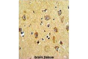 Immunohistochemistry (IHC) image for anti-Protein Phosphatase 2, Regulatory Subunit B, beta (PPP2R2B) antibody (ABIN3003824)