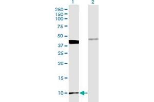 Western Blot analysis of MOBP expression in transfected 293T cell line by MOBP monoclonal antibody (M08), clone 4C2.
