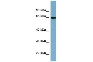WB Suggested Anti-CBFA2T2 Antibody Titration:  0.