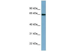 WB Suggested Anti-CBFA2T2 Antibody Titration:  0. (CBFA2T2 anticorps  (Middle Region))