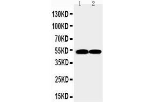 Anti-FLI1 antibody, Western blotting Lane 1: JURKAT Cell Lysate Lane 2: RAJI Cell Lysate
