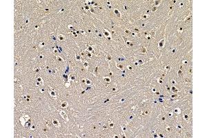 ABIN7097120 and ABIN7101188 at 1/100 staining mouse brain tissue by IHC-P. (ZNF233 anticorps)