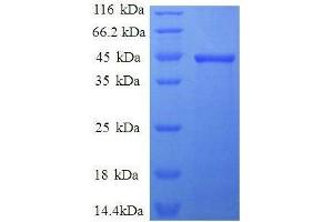 Interleukin 1, beta (IL1B) (AA 117-269) protein (GST tag)