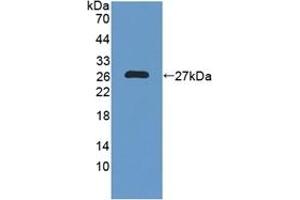 Detection of Recombinant NXN, Human using Polyclonal Antibody to Nucleoredoxin (NXN) (NXN anticorps  (AA 166-327))