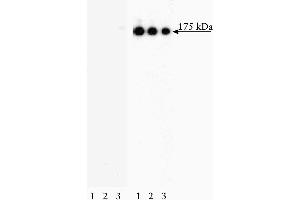 Western blot analysis of EGF Receptor (pY845) in human epidermis. (EGFR anticorps  (pTyr845))