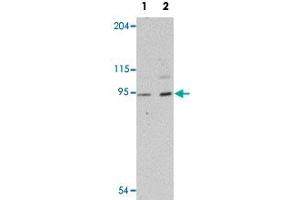 Western blot analysis of human heart tissue with LZTR1 polyclonal antibody  at (Lane 1) 1 and (Lane 2) 2 ug/mL dilution. (LZTR1 anticorps  (N-Term))