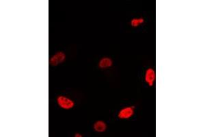 Immunofluorescent analysis of c-Myc staining in Jurkat cells. (c-MYC anticorps  (C-Term))