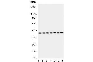 Western blot testing of ARA9 antibody and Lane 1:  HeLa;  2: COLO320;  3: HT1080;  4: MCF-7;  5: SW620;  6: U87;  7: MM231;  Predicted/Observed size: 37KD (AIP anticorps  (AA 91-330))