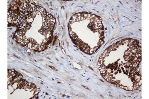 Image no. 3 for anti-SERPINE1 mRNA Binding Protein 1 (SERBP1) (AA 1-262) antibody (ABIN1490675)