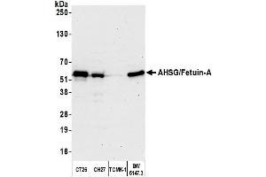 Western Blotting (WB) image for anti-alpha-2-HS-Glycoprotein (AHSG) (AA 25-75) antibody (ABIN7449953)