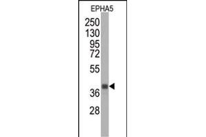 Western blot analysis of anti-EPHA5 Monoclonal Antibody (ABIN387809 and ABIN2843902) by EPHA5 recombinant protein (Fragment). (EPH Receptor A5 anticorps)