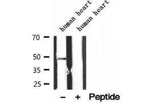 Western blot analysis of extracts of human heart tissue, using ATPB antibody. (ATP5B anticorps  (Internal Region))