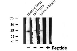 Western blot analysis of STARD10 expression in various lysates