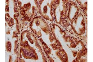 anti-Anti-Mullerian Hormone (AMH) (AA 26-560) antibody