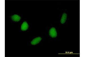 Immunofluorescence of purified MaxPab antibody to NUDT6 on HepG2 cell. (NUDT6 anticorps  (AA 1-316))
