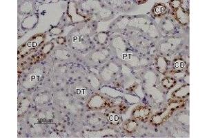 Expression of TRPV5 in rat kidney - Immunohistochemical staining of rat kidney paraffin embedded section using Anti-TRPV5 Antibody (ABIN7043855, ABIN7043996 and ABIN7043997), (1:100).