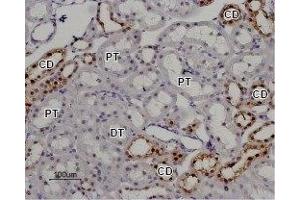 Expression of TRPV5 in rat kidney - Immunohistochemical staining of rat kidney paraffin embedded section using Anti-TRPV5 Antibody (ABIN7043855, ABIN7043996 and ABIN7043997), (1:100). (TRPV5 anticorps  (C-Term, Intracellular))