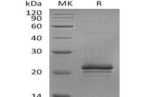 Western Blotting (WB) image for Vascular Endothelial Growth Factor A (VEGFA) protein (ABIN7321249) (VEGFA Protéine)