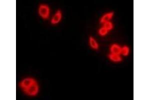 Immunofluorescent analysis of RAB5A staining in Hela cells. (RAB5 anticorps)