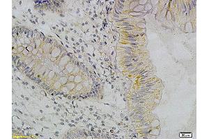 Immunohistochemistry (IHC) image for anti-Tumor Necrosis Factor alpha (TNF alpha) antibody (ABIN722481) (TNF alpha anticorps)