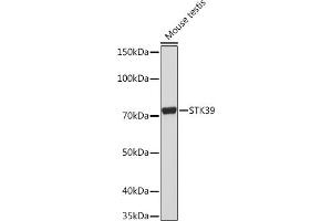 Western blot analysis of extracts of Mouse testis, using STK39 Rabbit mAb (ABIN1682890, ABIN3015922, ABIN3015923 and ABIN7101461) at 1:1000 dilution.
