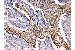 IHC analysis of ACTN3/Alpha Actinin 3 using anti- ACTN3/Alpha Actinin 3 antibody .