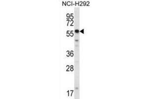 Western Blotting (WB) image for anti-SET and MYND Domain Containing 2a (SMYD2A) antibody (ABIN2995651) (SMYD2A anticorps)