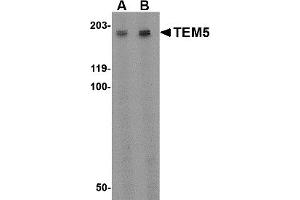 Western Blotting (WB) image for anti-G Protein-Coupled Receptor 124 (GPR124) (Middle Region) antibody (ABIN1031119) (GPR124 anticorps  (Middle Region))
