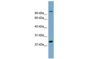 SEMA3D antibody used at 1 ug/ml to detect target protein. (SEMA3D anticorps  (Middle Region))