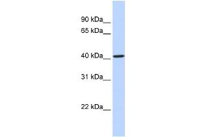 WB Suggested Anti-CYP4F12 Antibody Titration:  0. (CYP4F12 anticorps  (Middle Region))