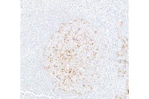 Immunohistochemistry (IHC) image for anti-Programmed Cell Death 1 Ligand 2 (PDCD1LG2) (AA 20-220) antibody (ABIN7795675) (Recombinant PDCD1LG2 anticorps  (AA 20-220))