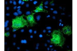 Anti-KATNB1 mouse monoclonal antibody (ABIN2455210) immunofluorescent staining of COS7 cells transiently transfected by pCMV6-ENTRY KATNB1 (RC201852). (KATNB1 anticorps)