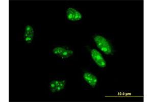 Immunofluorescence of monoclonal antibody to CDX1 on HeLa cell.