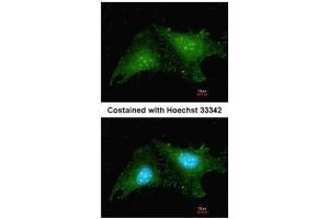 ICC/IF Image Immunofluorescence analysis of methanol-fixed HeLa, using RNF25, antibody at 1:200 dilution.