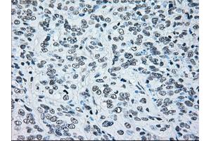 Image no. 3 for anti-B-Raf proto-oncogene, serine/threonine kinase (BRAF) antibody (ABIN1496961)