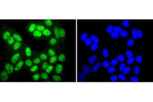 HeLa cells were stained with SIRT1(T530) (6H5) Monoclonal Antibody  at [1:200] incubated overnight at 4C, followed by secondary antibody incubation, DAPI staining of the nuclei and detection. (SIRT1 anticorps  (pThr530))