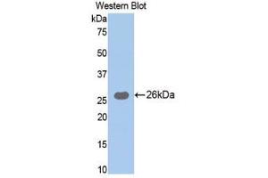 Western Blotting (WB) image for anti-Trypsin (AA 9-231) antibody (ABIN1077670)