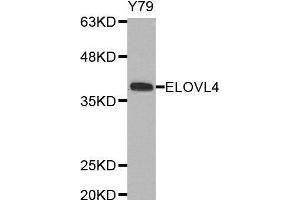 Western blot analysis of extracts of Y79 cell line, using ELOVL4 antibody. (ELOVL4 anticorps  (AA 1-100))