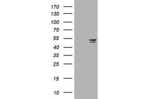Image no. 3 for anti-Thymidine Phosphorylase (TYMP) (AA 311-482) antibody (ABIN1491395) (Thymidine Phosphorylase anticorps  (AA 311-482))