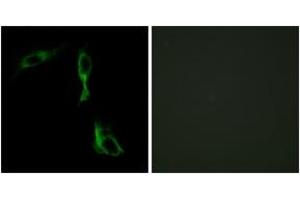 Immunofluorescence analysis of HeLa cells, using ADRA1D Antibody. (ADRA1D anticorps  (AA 451-500))