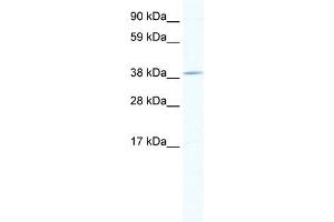 WB Suggested Anti-TOB1 Antibody Titration:  1. (Protein Tob1 (TOB1) (Middle Region) anticorps)