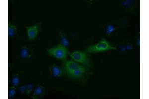 Anti-KLHL2 mouse monoclonal antibody (ABIN2453211) immunofluorescent staining of COS7 cells transiently transfected by pCMV6-ENTRY KLHL2 (RC205347). (KLHL2 anticorps  (AA 1-100, AA 494-593))