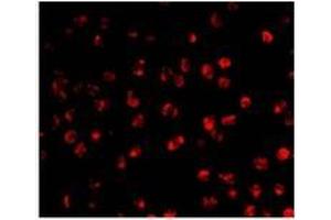 Immunofluorescence of AID in Ramos cells with AP30028PU-N Ramos antibody at 20 μg/ml.