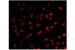 Immunofluorescence of AID in Ramos cells with AP30028PU-N Ramos antibody at 20 μg/ml. (AICDA anticorps  (C-Term))